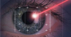 Oogbeschadiging symptomen door laser